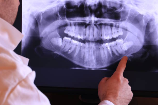 Best Same-Day Emergency Dentist in Moyie Springs, ID
