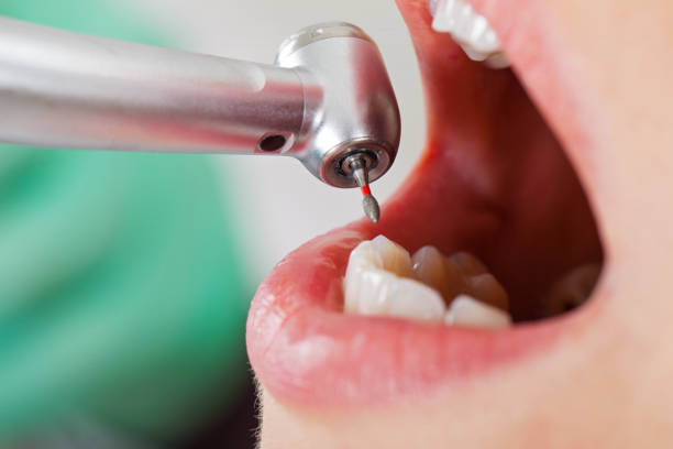 Best Emergency Treatment for Toothache in Moyie Springs, ID